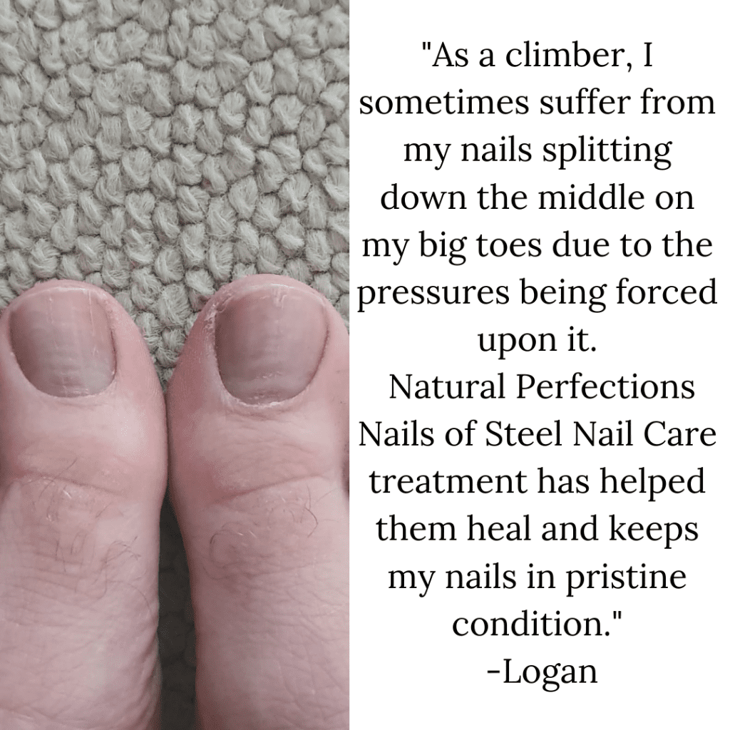 logan toes